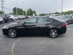 2015 Acura TLX Tech